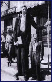 Acromegaly or Gigantism